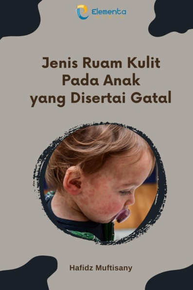Jenis Ruam Kulit pada Anak yang Disertai Gatal